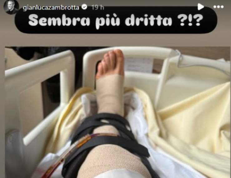 la gamba di Zambrotta operata